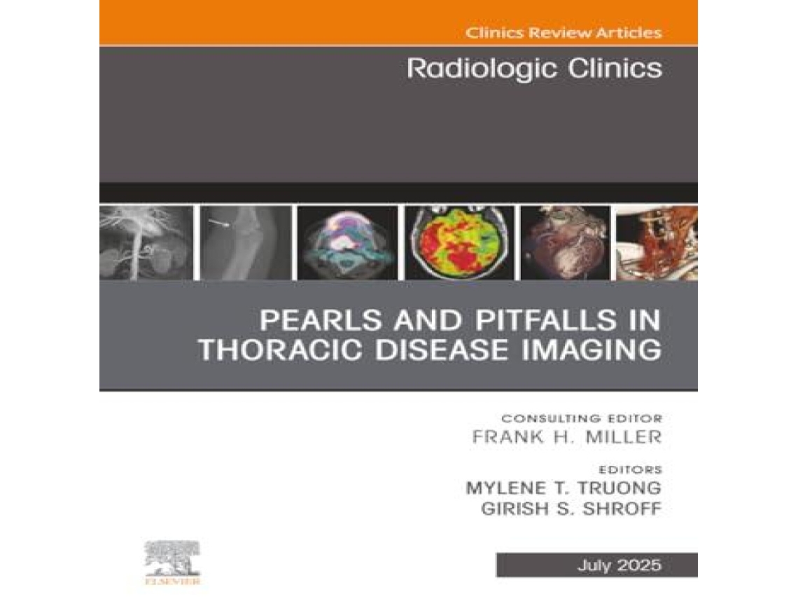 Livro Pearls and Pitfalls in Thoracic Disease Imaging An Issue of Radiologic Clinics of North America de Mylene T Truong (Inglês)