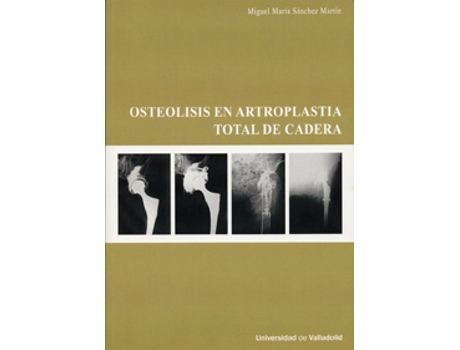 Livro Osteolisis En Artroplastia Total De Cadera de Miguel Maria Sanchez Martin (Espanhol)