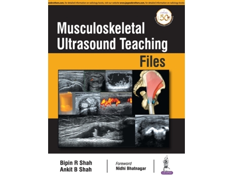 Livro musculoskeletal ultrasound teaching files de bipin r shah,ankit b shah (inglês)