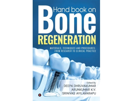 Livro Hand Book On Bone Regeneration De Deepa Dhruvakumar, Arun Kumar K V Et Al. (inglês)