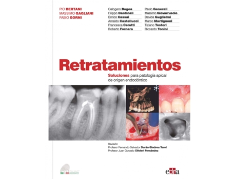 Livro Retratamientos. Soluciones Para Patología Apical De Origen Endodóntico de Calogero Bugea (Español)