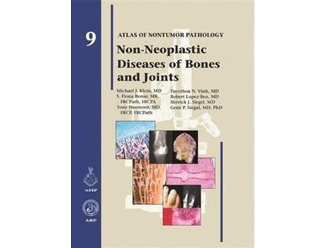 Livro NonNeoplastic Diseases of Bones and Joints Atlas of Nontumor Pathology de Michael J Klein (Inglês)