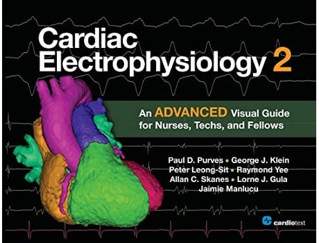 Livro Cardiac Electrophysiology 2 An Advanced Visual Guide for Nurses Techs and Fellows de Paul D Purves (Inglês)