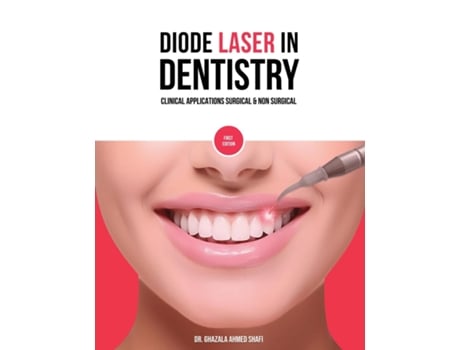 Livro Diode Laser In Dentistry - Clinical Applications Surgical amp Non Surgical de Ghazala Ahmed Shafi (Inglês)