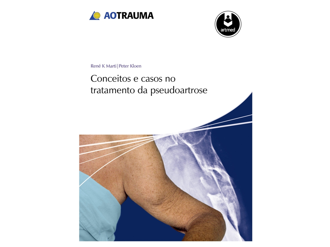 Livro Conceitos E Casos No Tratamento Da Pseudoartrose