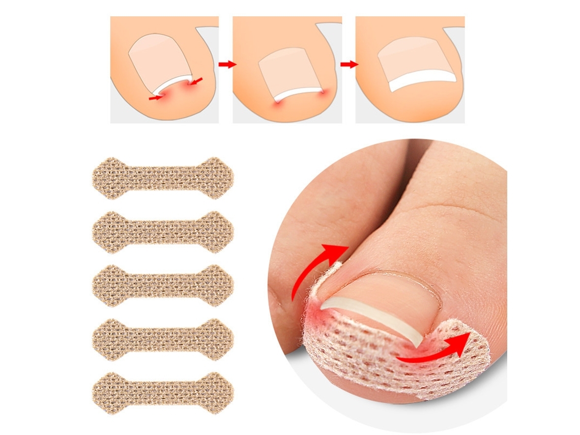 Gesso para Unhas Encravadas Bege