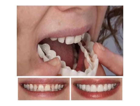 Par De Próteses Cosméticas De Facetas Dentes Temporários Superior E Inferior Dentes Falsos Temporários Próteses Cosméticas Hb014