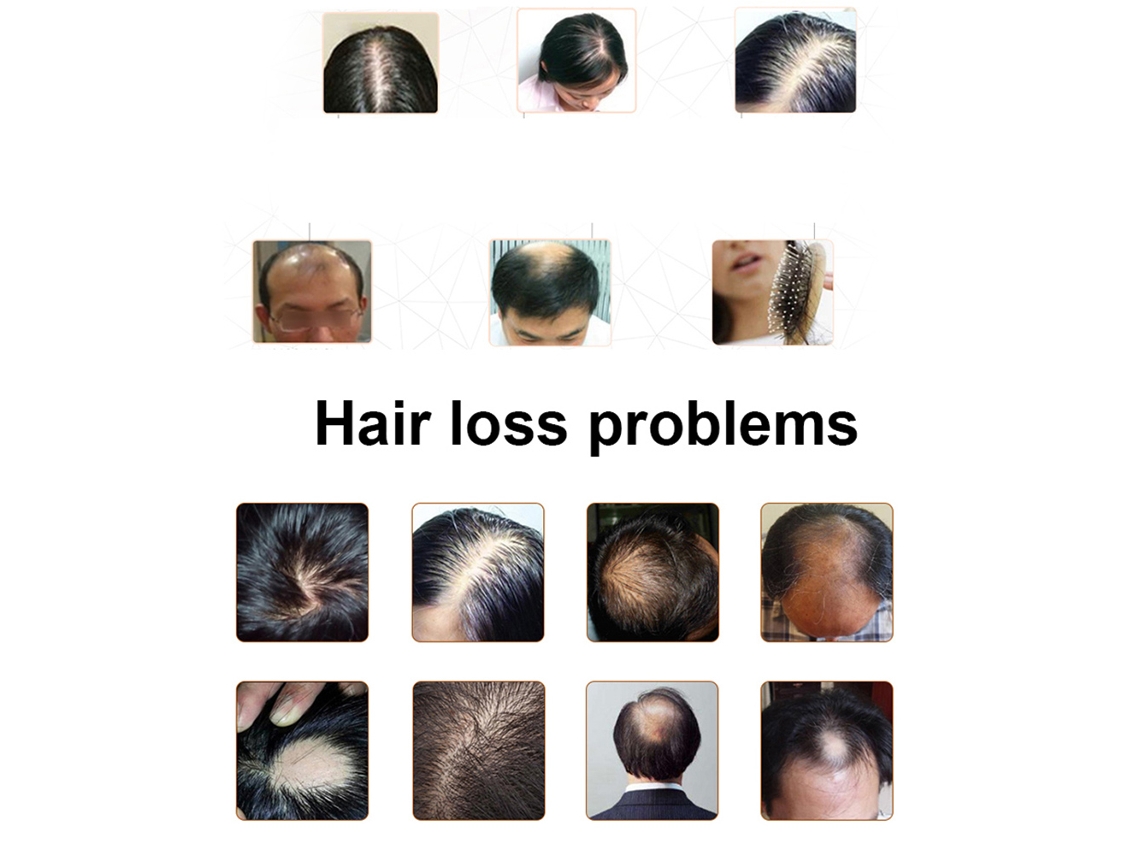 Essência De Crescimento Capilar 30ml Com Ingredientes Naturais Para Prevenir Queda E Reparar Cabelo Saudável