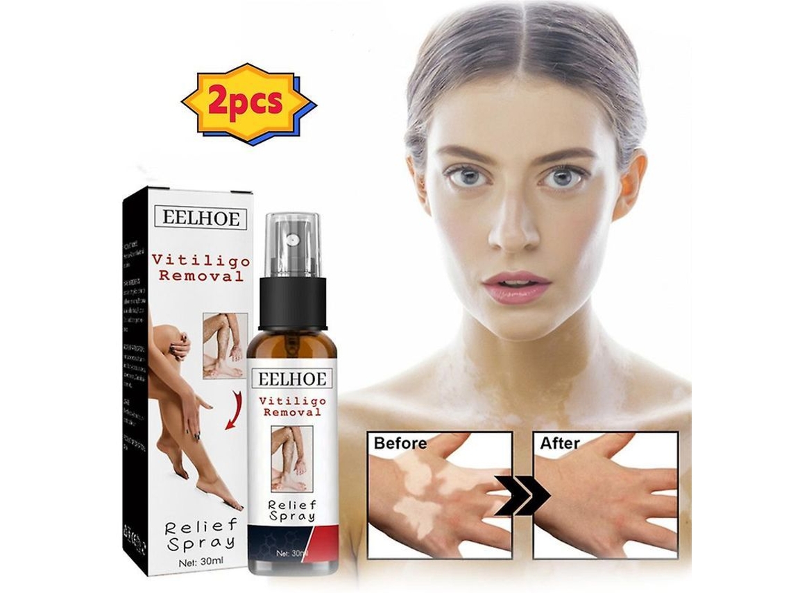 2026 2pcs Spray Reparador de Piel para Vitiligo, Reduce Manchas Blancas, Repara Piel Y Mejora Pigmentación Natural