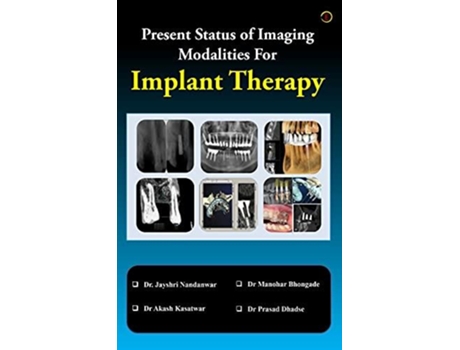 Livro Present Status Of Imaging Modalities For Implant Therapy De Jayshri Nandanwar (inglês)