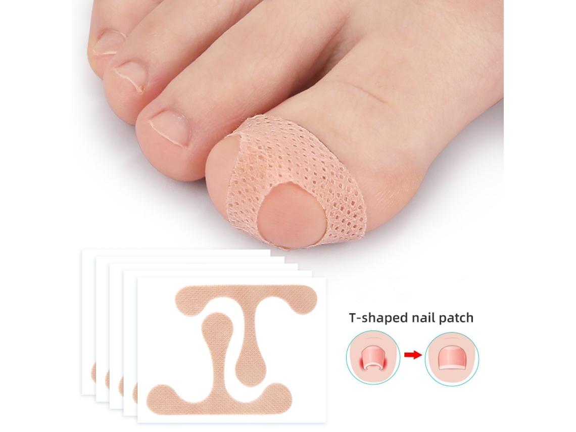 Adesivos para Correção de Unhas Encravadas INF