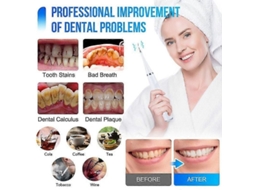 Escova De Dentes Inteligente, Escova De Dentes Elétrica Para Remover Manchas E Tártaro, Clareamento Dental.