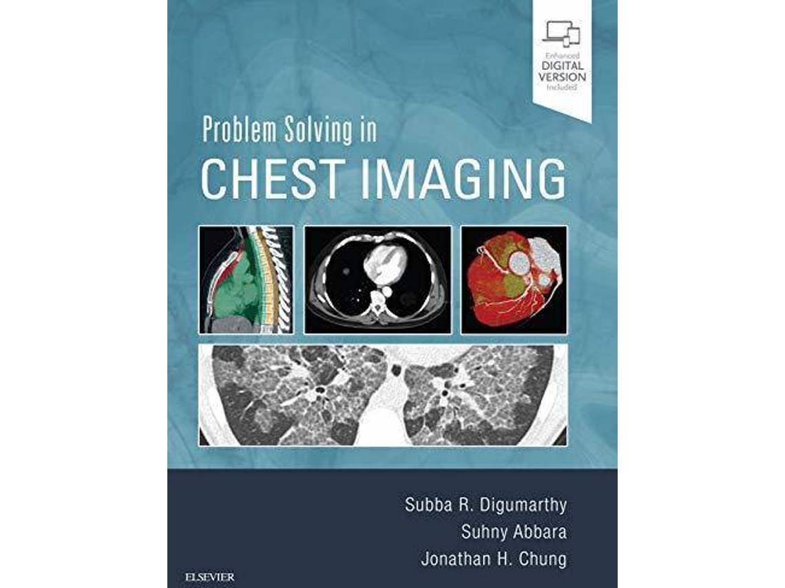 Livro Problem Solving In Chest Imaging de Abbara Digumarthy (Inglês)