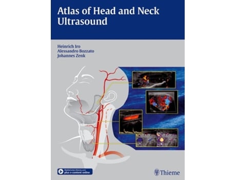 Livro Atlas of Head and Neck Ultrasound de Heinrich Iro, Alessandro Bozzato et al. (Inglês - Capa Dura)