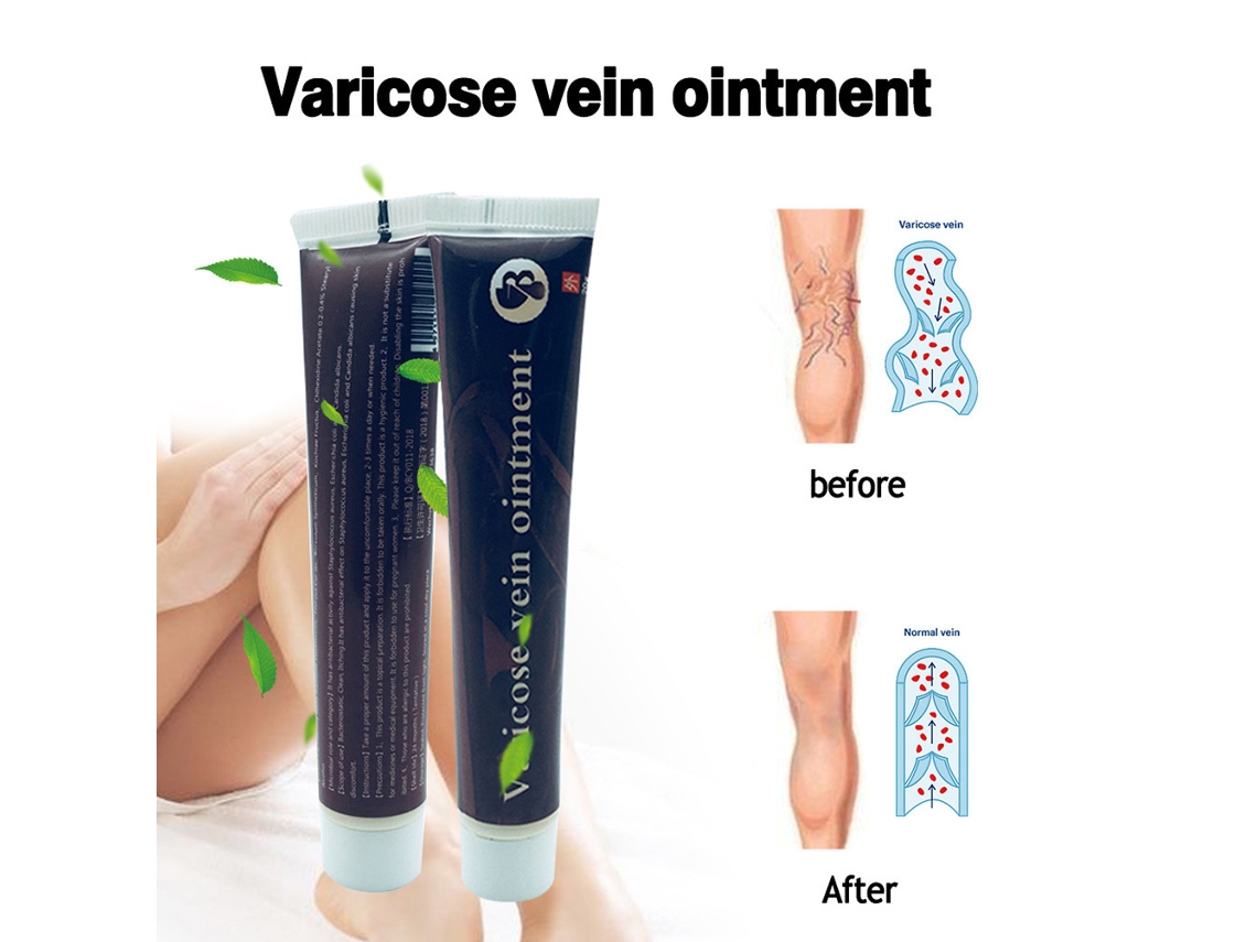Creme Efetivo Para Varizes, Vasculite E Flebite