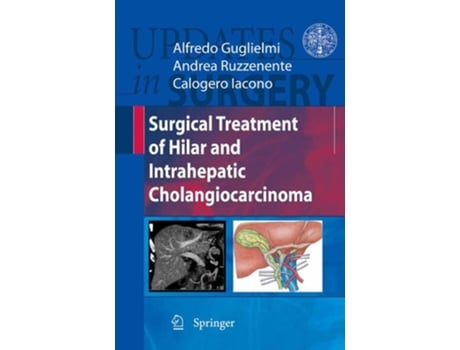 Livro Surgical Treatment Of Hilar And Intrahepatic Cholangiocarcinoma De Alfredo Guglielmi (inglês)