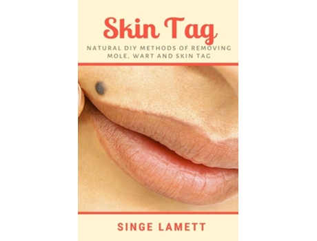 Livro Skin Tag Natural Diy Methods Of Removing Mole, Wart And Skin Tag De Singe Lamett (inglês)