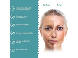 Massajador Facial Geração para Aquecimento Facial Máquina Facial Homens Mulheres Pescoço Queixo Olhos Braço Pernas Corpo Branco AUJEZON