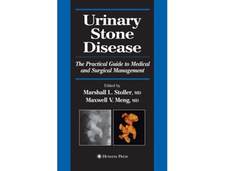 Livro Urinary Stone Disease De Marshall L Stoller E Maxwell V Meng (inglês)