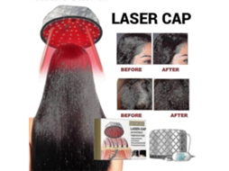 Boné de Terapia Luz Vermelha com Tecnologia Laser Infravermelho Led para Tratamento Crescimento Capilar 50 % Oferta Especial GOKOCO