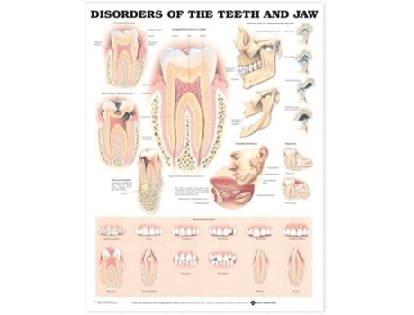Livro Disorders of the Teeth and Jaw Anatomical Chart de Anatomical Chart Company (Inglês)