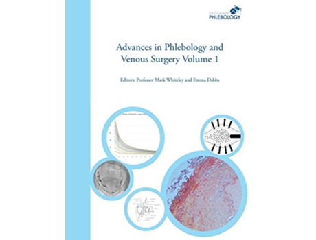 Livro Advances in Phlebology and Venous Surgery Volume 1 de Mark Whiteley (Inglês)