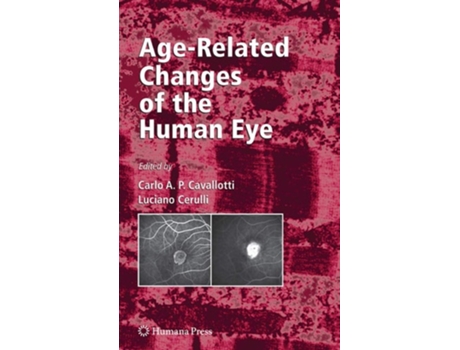Livro Age-Related Changes of the Human Eye de Carlo Cavallotti ( Inglês )