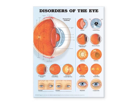 Livro disorders of the eye anatomical chart de prepared for publication by anatomical chart company (inglês)