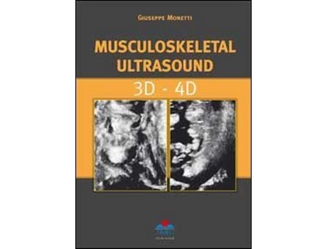 Livro Musculoskeletal Ultrasound 3D 4D de Giuseppe Monetti (Inglês - Capa Dura)