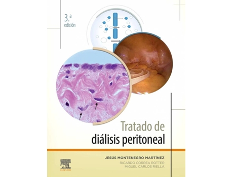 Livro Tratado De Diálisis Peritoneal de Jesús Montenegro Martínez (Espanhol)